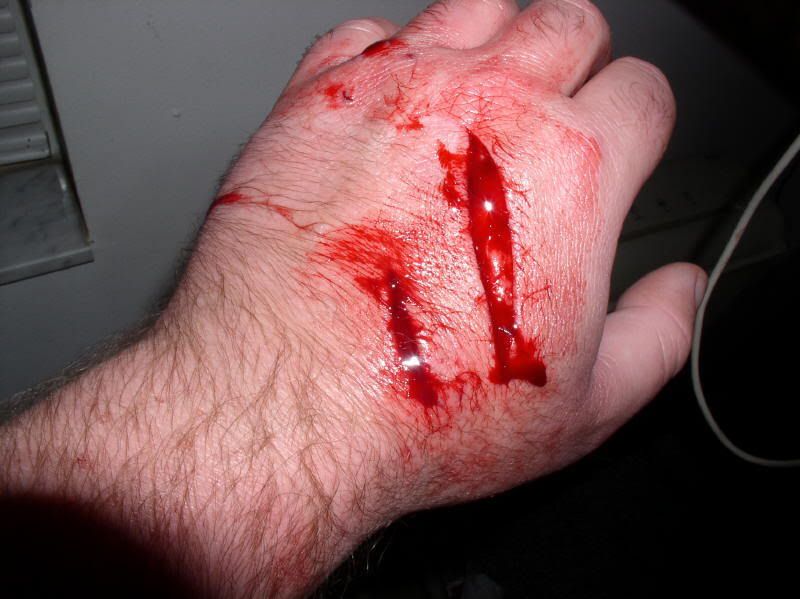 croc_hand_wound.jpg