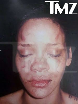 rihanna pictures after beating. After beating 20-year-old Ramp;B